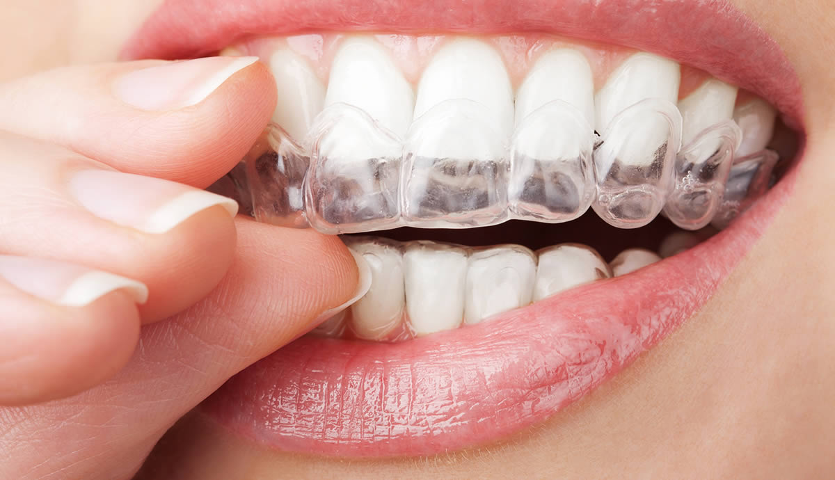 Orthodontic Specialist Experts Braces Invisalign And Plates