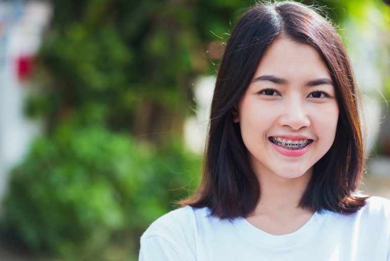 A woman wearing braces shares a smile.