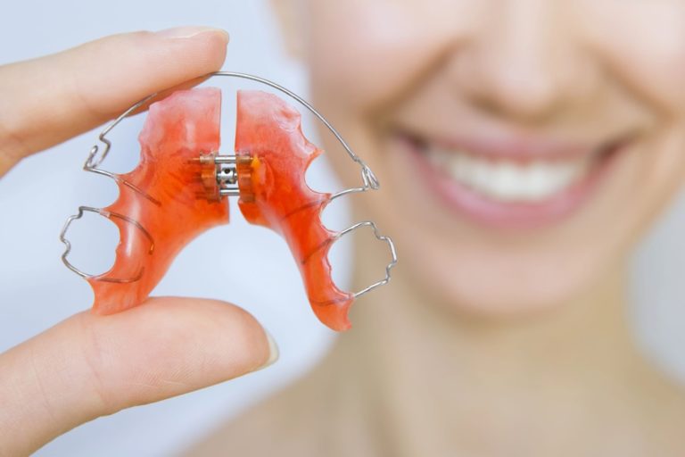 A smiling woman shows off her removable plates.